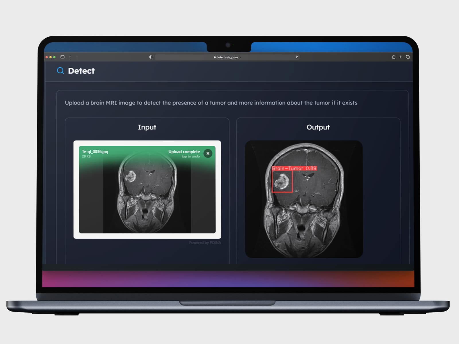 Medalgo | Brain Tumor Detector - Image 4