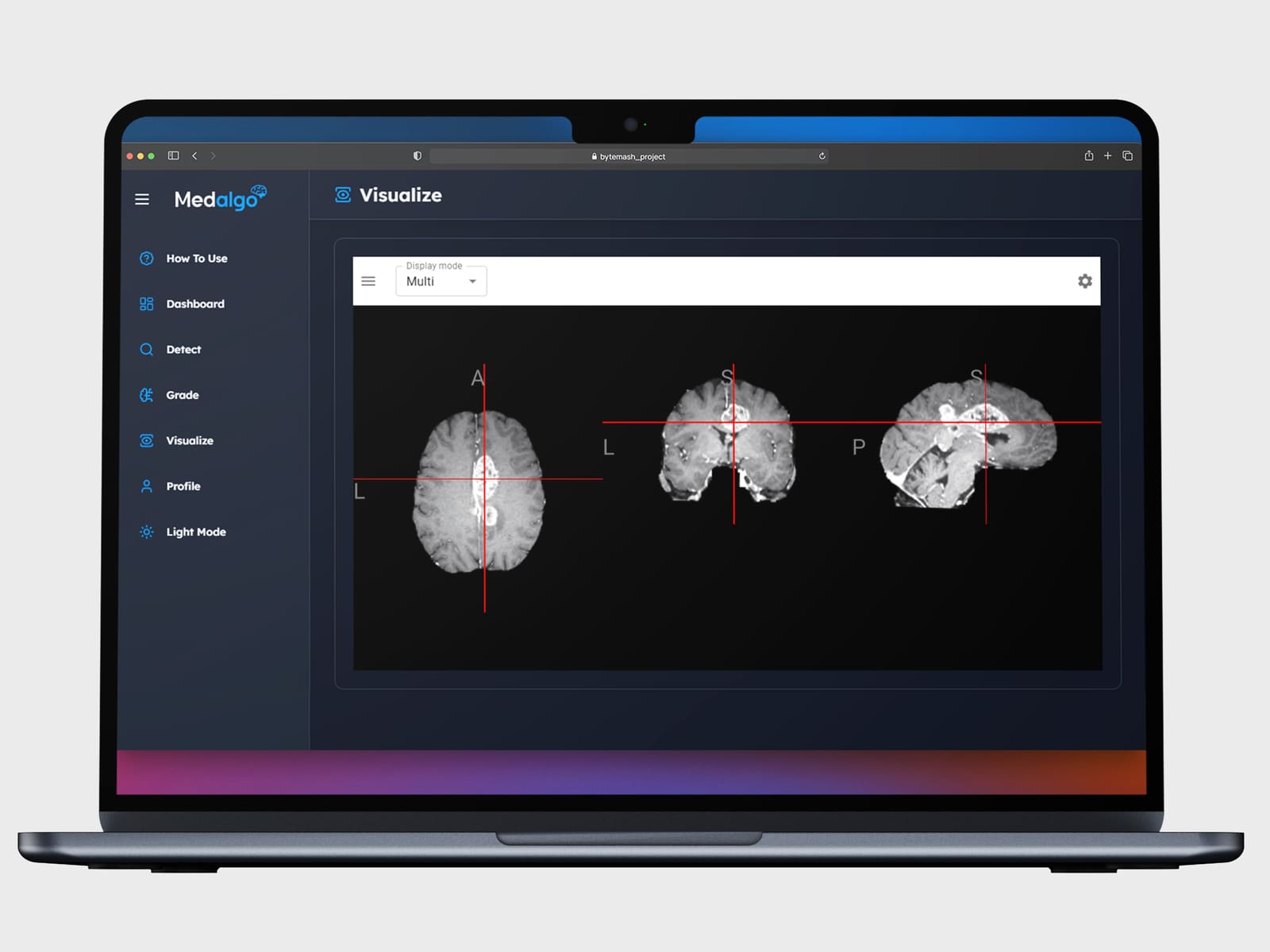 Medalgo | Brain Tumor Detector - Image 7