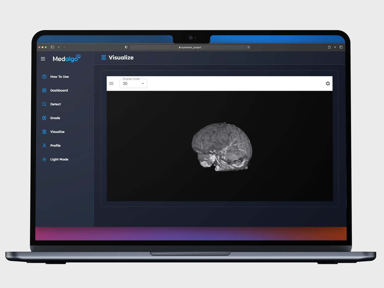 Medalgo | Brain Tumor Detector - Image 8